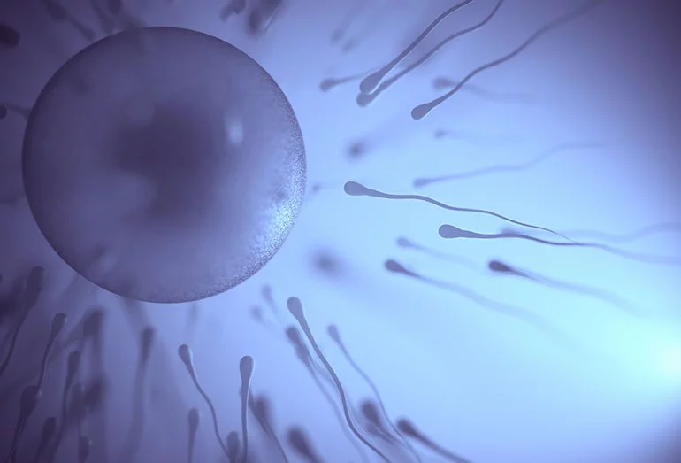 درمان ناباروری با IUI