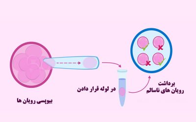 تعیین جنسیت