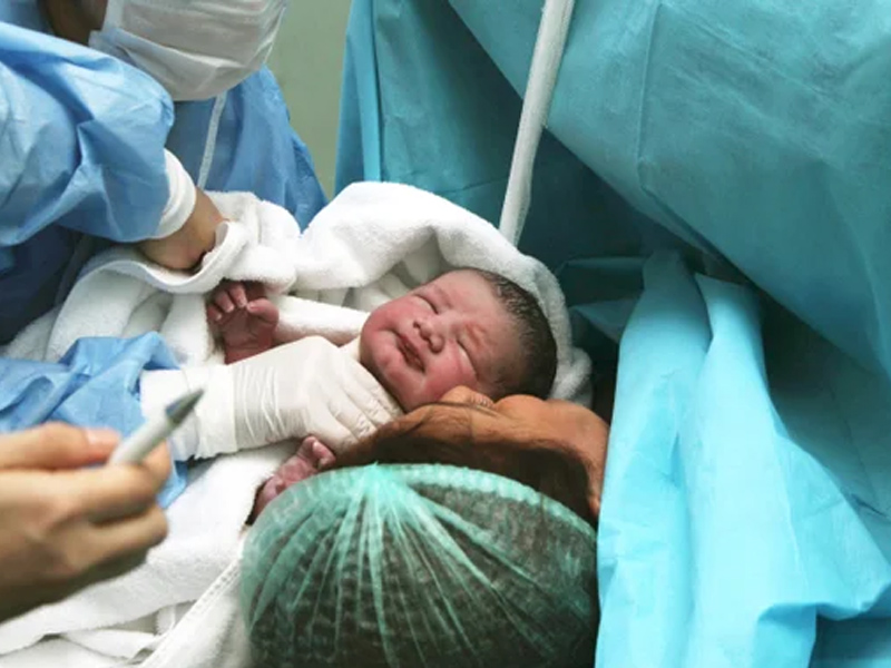 زایمان طبیعی