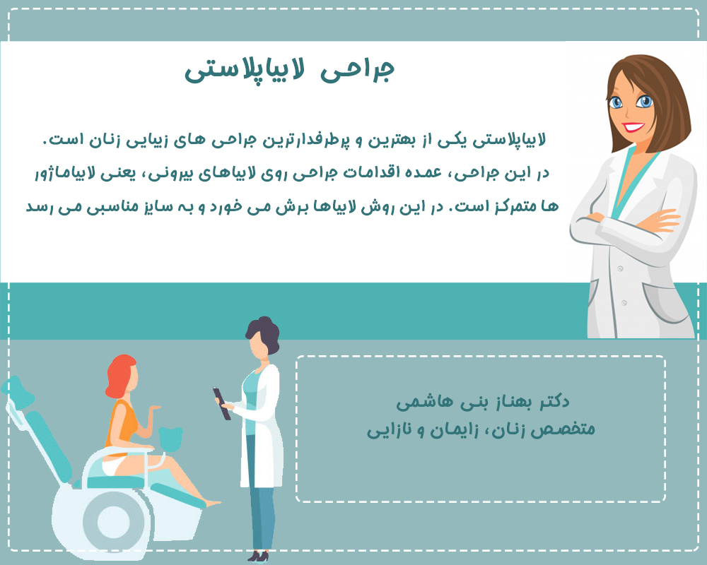 جراحی لابیاپلاستی در شهر اصفهان