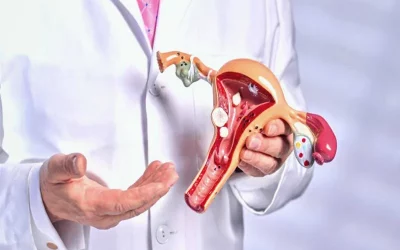 کیست تخمدان