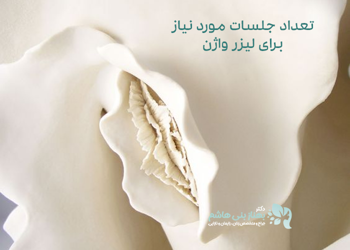 تعداد جلسات مورد نیاز برای لیزر واژن